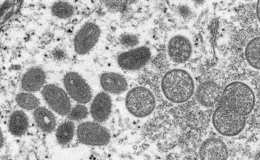 An electron microscopic (EM) image depicting a monkeypox virion, obtained from a clinical sample associated with the 2003 prairie dog outbreak.